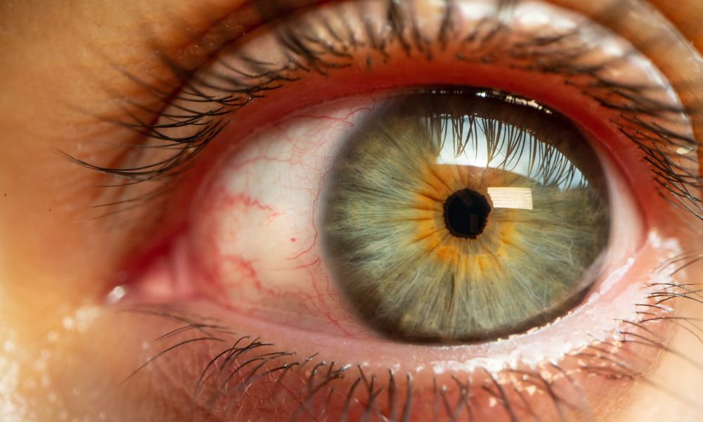 5 Ways Glaucoma Can Affect Everyday Life
